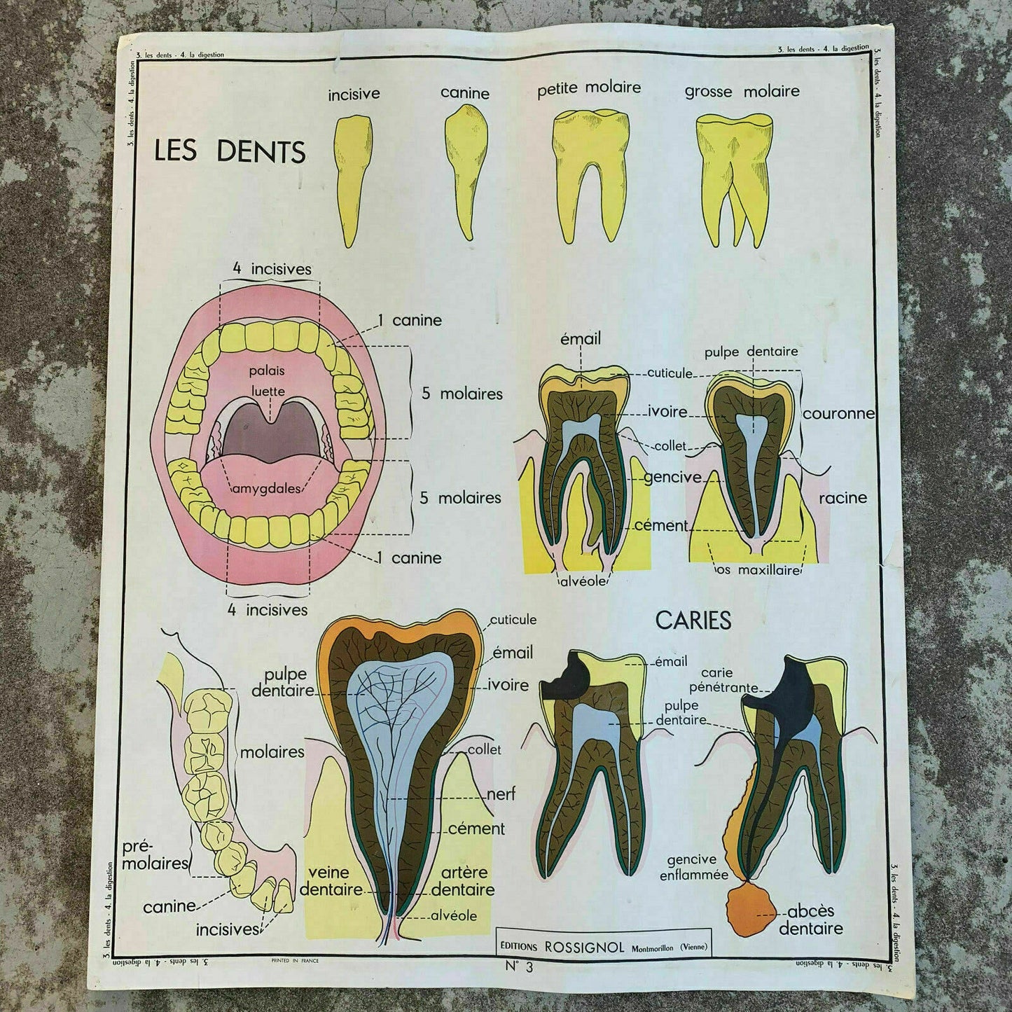 ROSSIGNOL MDI Vintage French School Poster anatomy Two Sides TEETH 1907198 - Fleamarketfrance