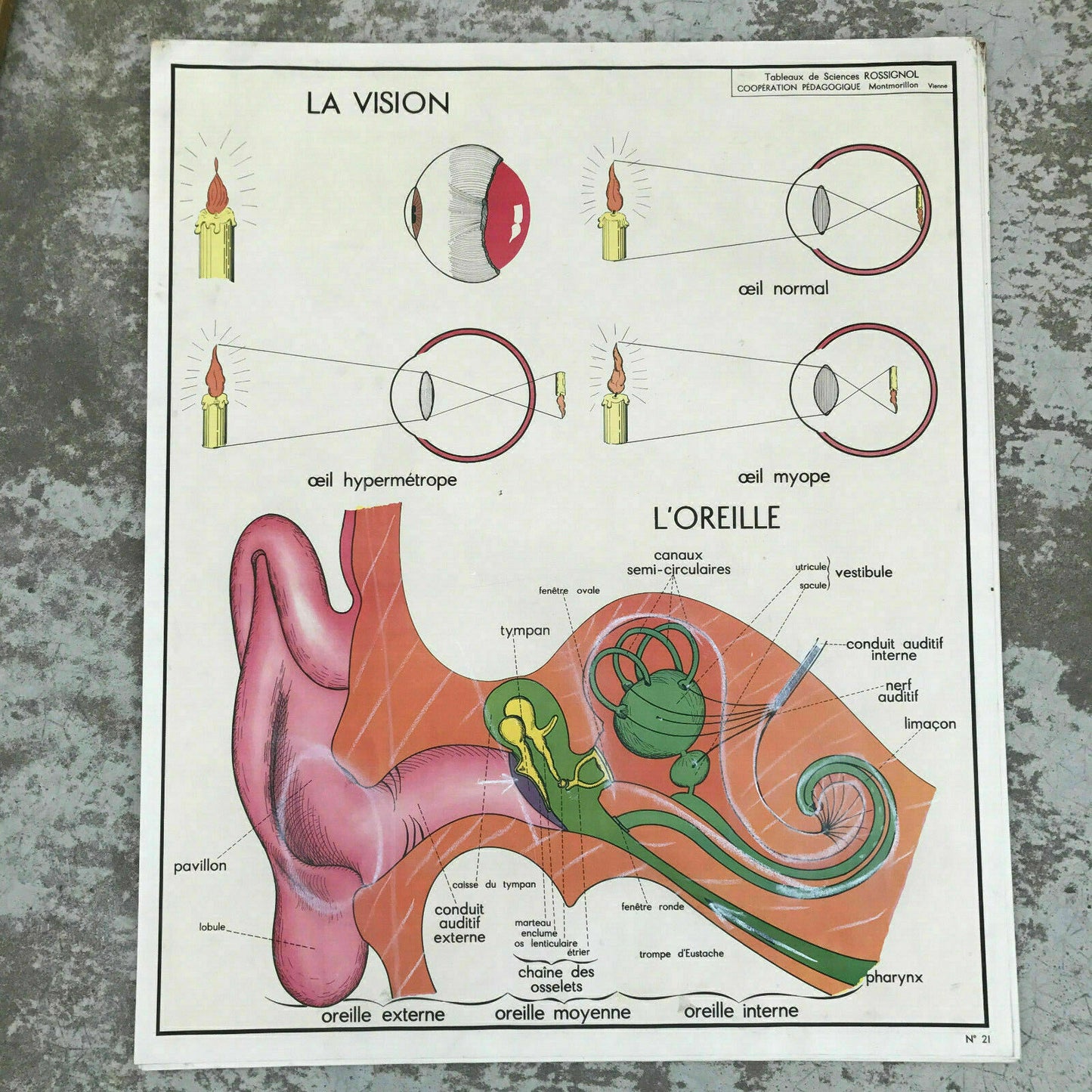 Vintage French Medical Poster Anatomy Alcoholism Vision Rossignol 1612193 Fleamarketfrance